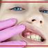 نشانه های دندان عفونی شده چیست؟